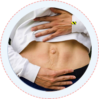 Liposuction Tummy Tuck
