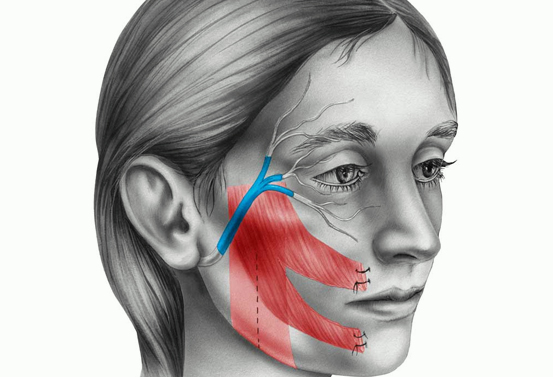 Face Rejuvenation